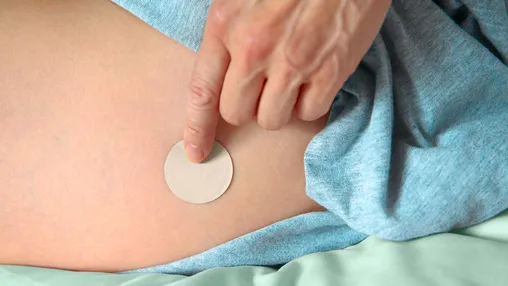 Estrogen Patches Are in Short Supply — Is There a Workaround?